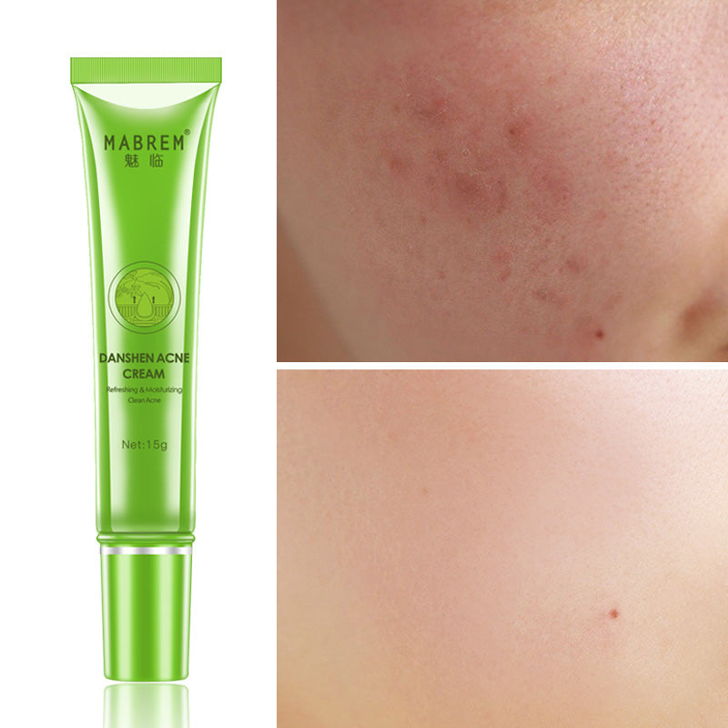 MABREM CLEAR DANSHEN ACNE CREAM